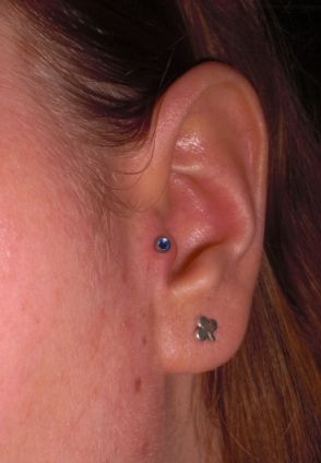 tragus.jpg
