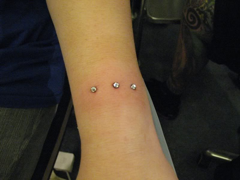 3 Microdermal Anchors on my wrist! (UPDATED with aftercare info at page 6)